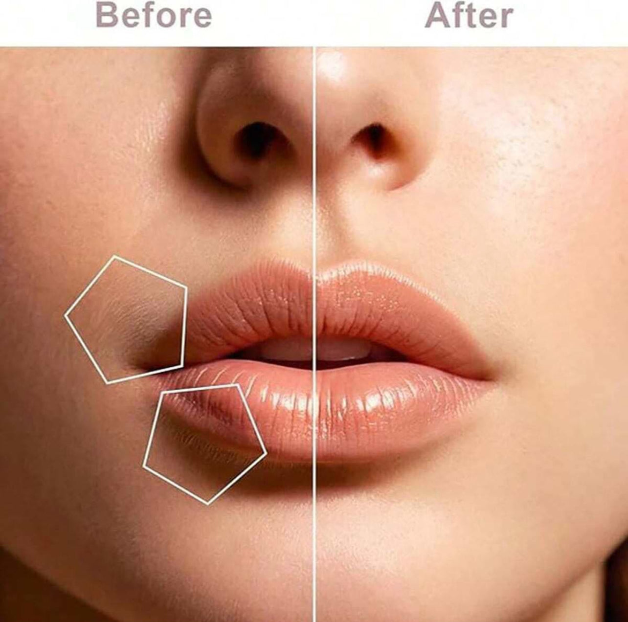 Women’s Facial Hair Remover – Portable USB Rechargeable Electric Shaver (Gold & White)